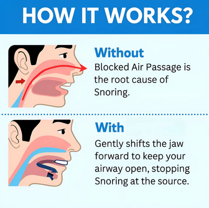 Zentrio® Anti Snoring Mouthpiece